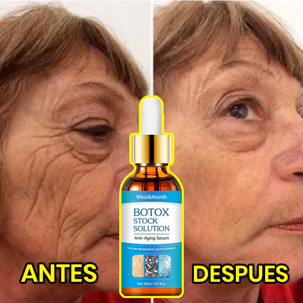 ¡Arma tu combo de Botox - Suero Antiarrugas - lleva 2 y te damos 55% en el 3ro! + Envío Gratis