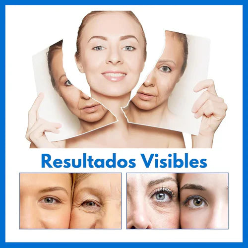¡Arma tu combo de Botox - Suero Antiarrugas - lleva 2 y te damos 55% en el 3ro! + Envío Gratis