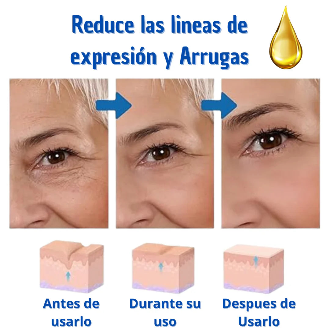 ¡Arma tu combo de Botox - Suero Antiarrugas - lleva 2 y te damos 55% en el 3ro! + Envío Gratis