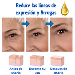 ¡Arma tu combo de Botox - Suero Antiarrugas - lleva 2 y te damos 55% en el 3ro! + Envío Gratis