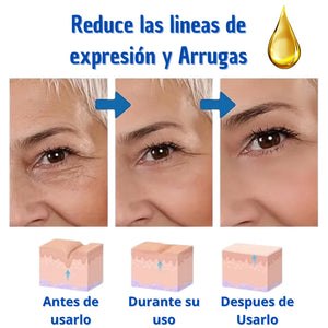 ¡Arma tu combo de Botox - Suero Antiarrugas - lleva 2 y te damos 55% en el 3ro! + Envío Gratis