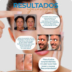 ¡Arma tu combo de Botox - Suero Antiarrugas - lleva 2 y te damos 55% en el 3ro! + Envío Gratis