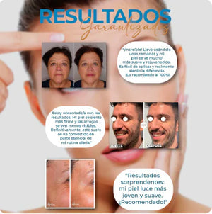 ¡Arma tu combo de Botox - Suero Antiarrugas - lleva 2 y te damos 55% en el 3ro! + Envío Gratis